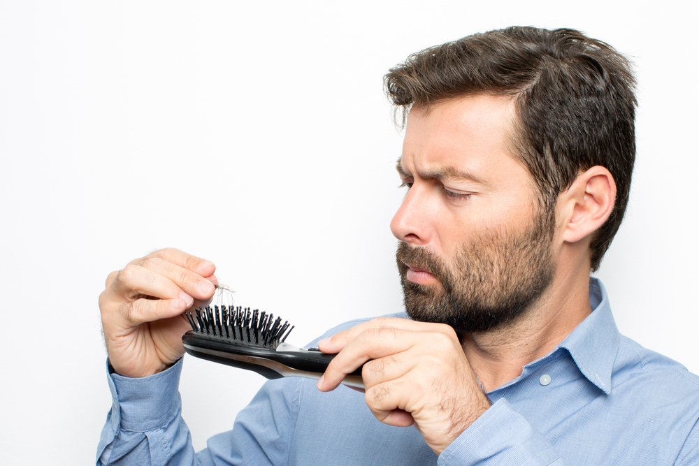 Men hair loss - GurusWay.com